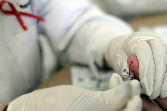 Cuatro de cada 10 de portadores del VIH desconocen su condición