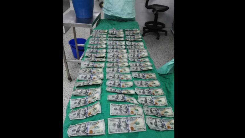 Mujer se traga 9.000 dólares luego de pelear con su expareja