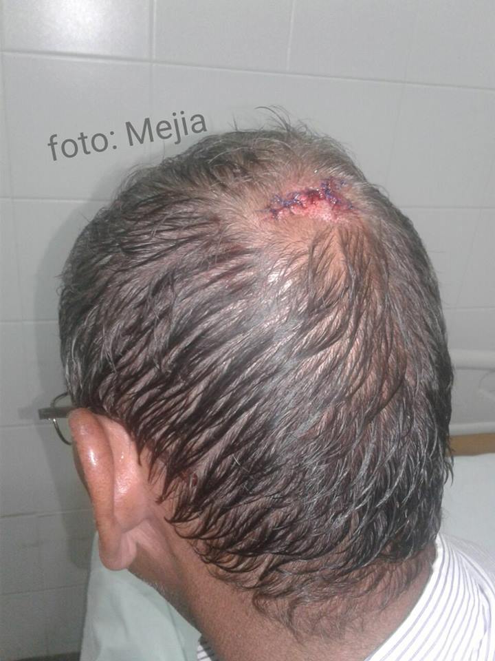 Por robarlo delincuentes agredieron a vendedor en Arauquita