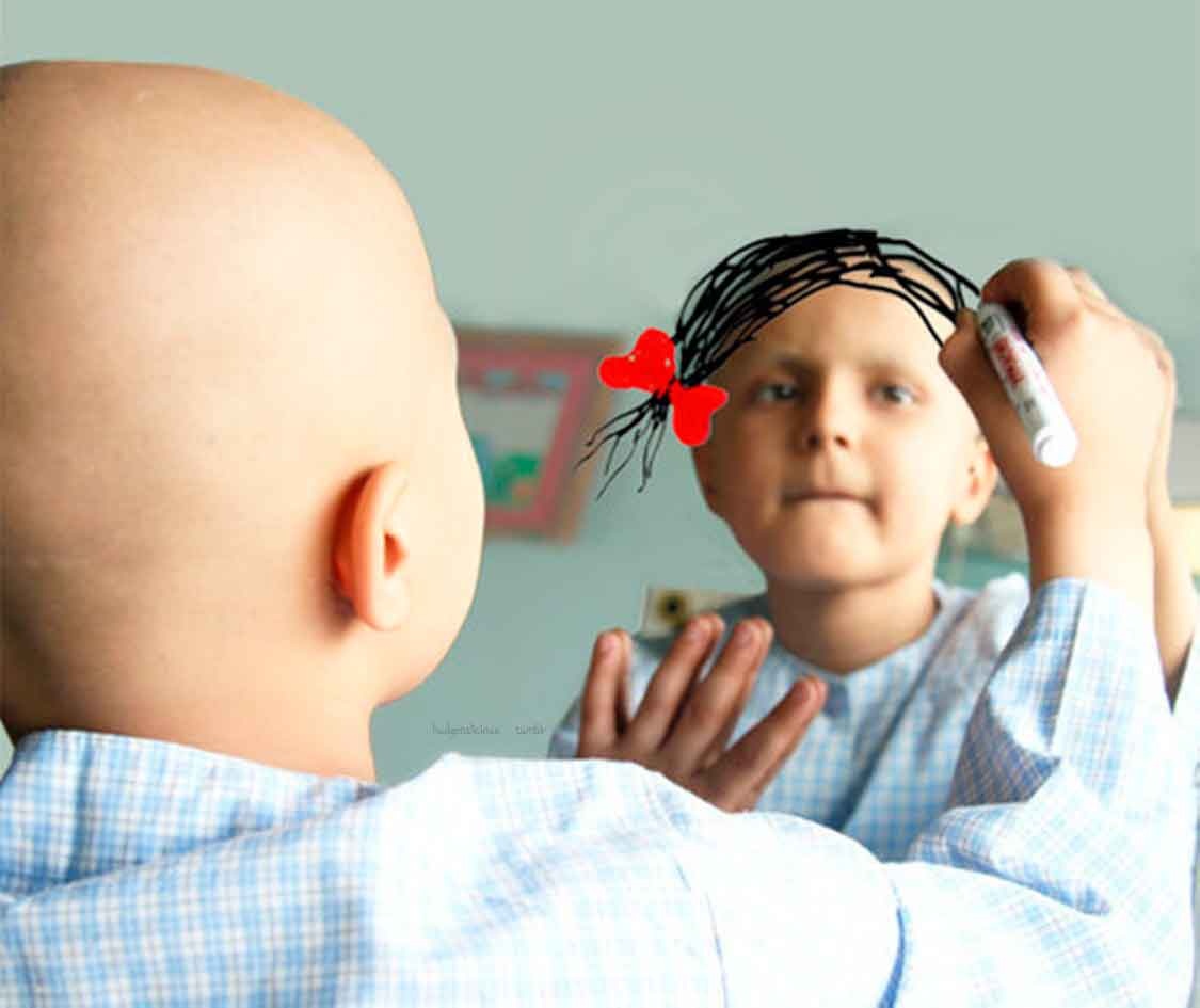 UAESA realiza seguimiento a EPSs para la atención a menores con cáncer