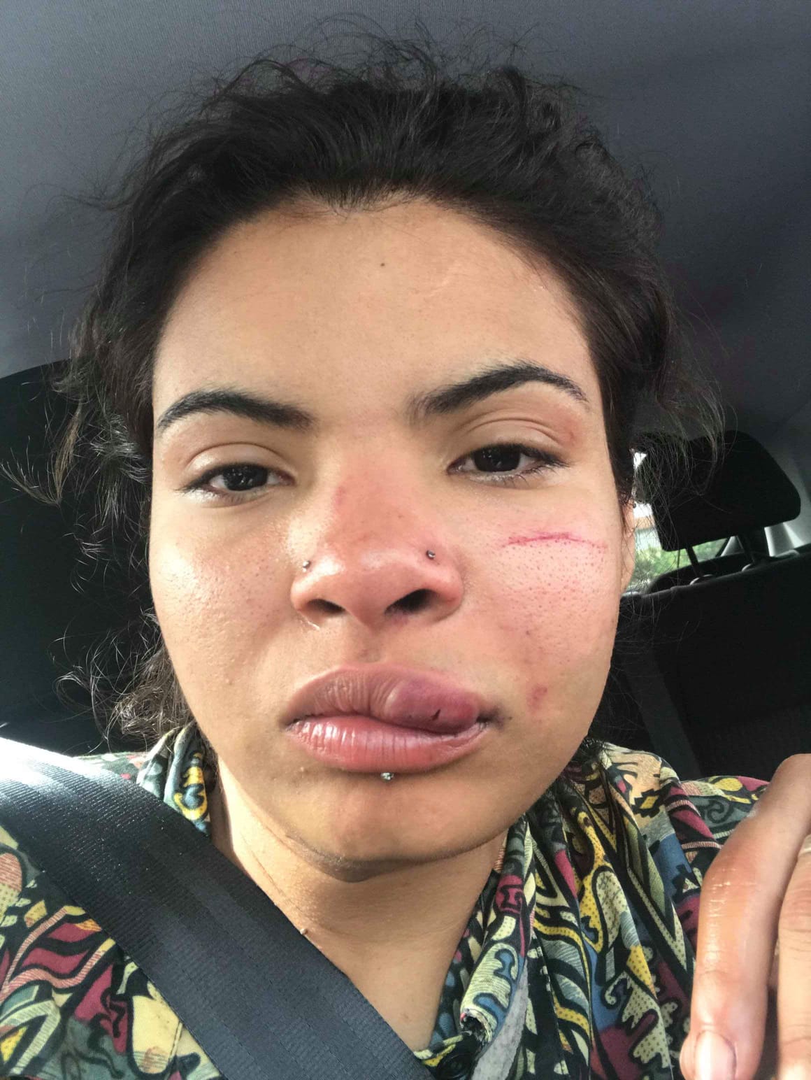 Joven colombiana radicada en Portugal fue golpeada brutalmente
