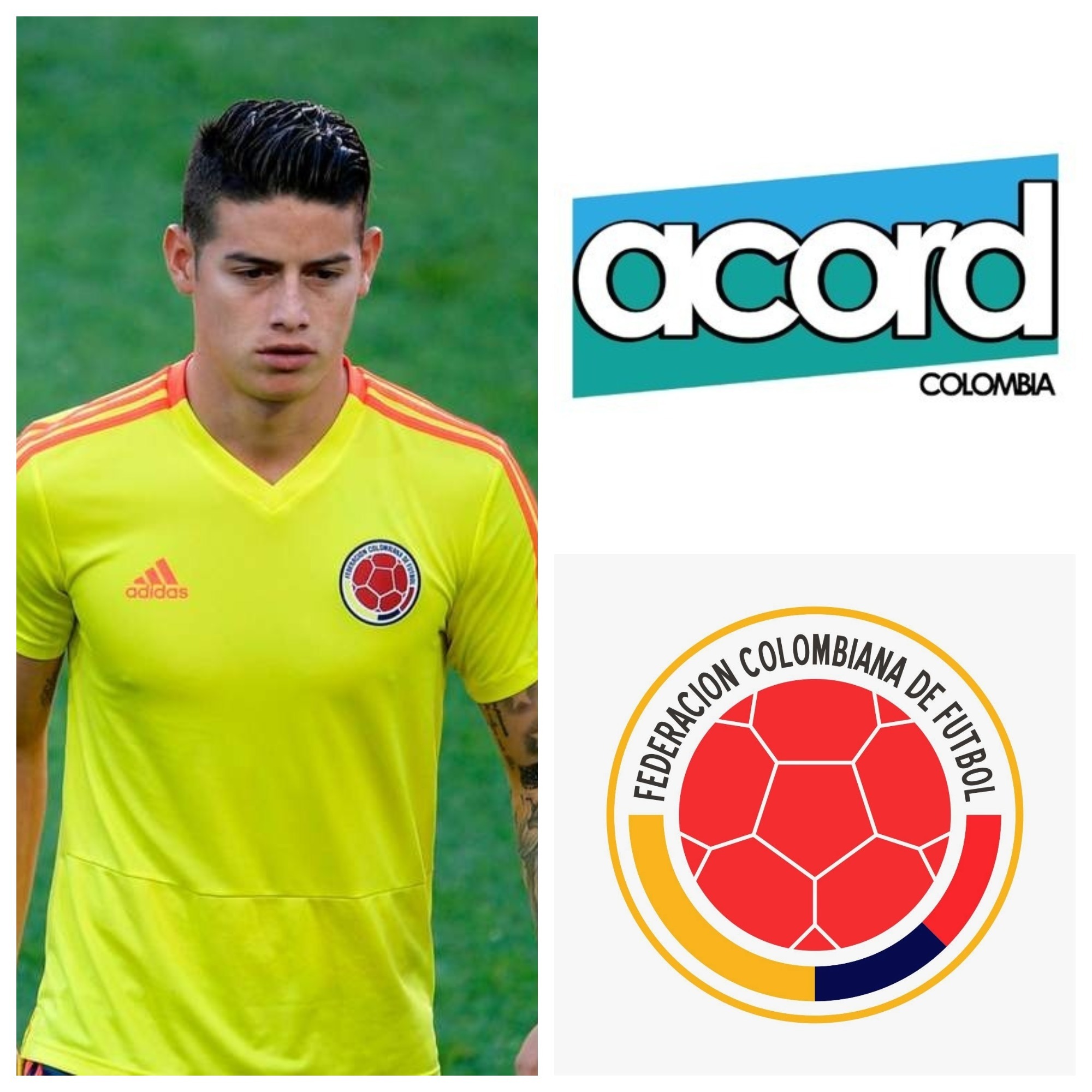 ACORD Rechaza mentiras de FCF Sobre la lesión de James Rodríguez