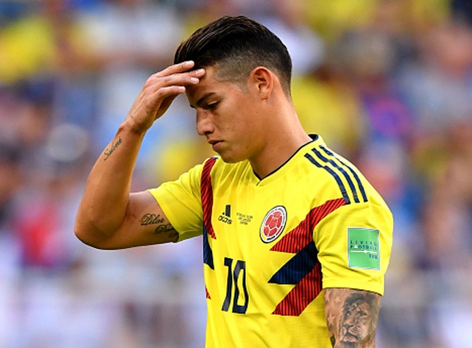 ¿Por qué se ocultó la verdad de la lesión de James?