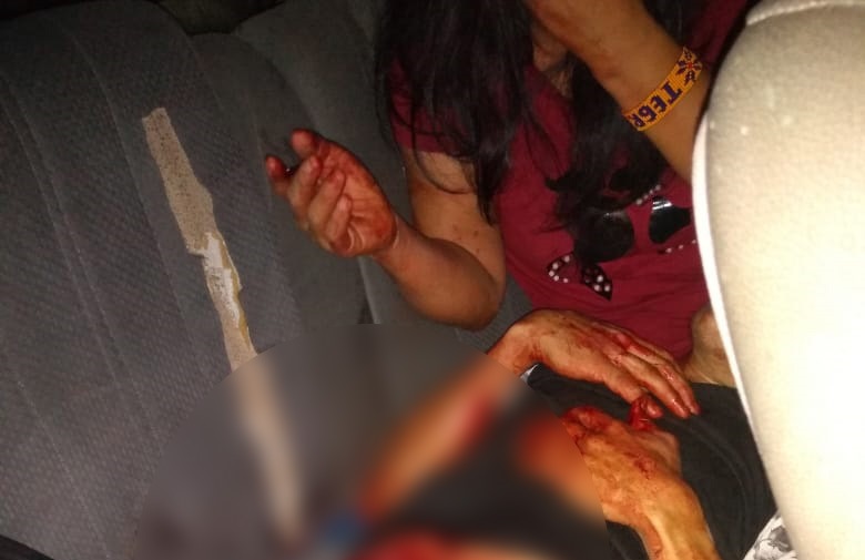 ¡Lo rajaron! Cansada del maltrato, mujer le abrió el abdomen a su pareja