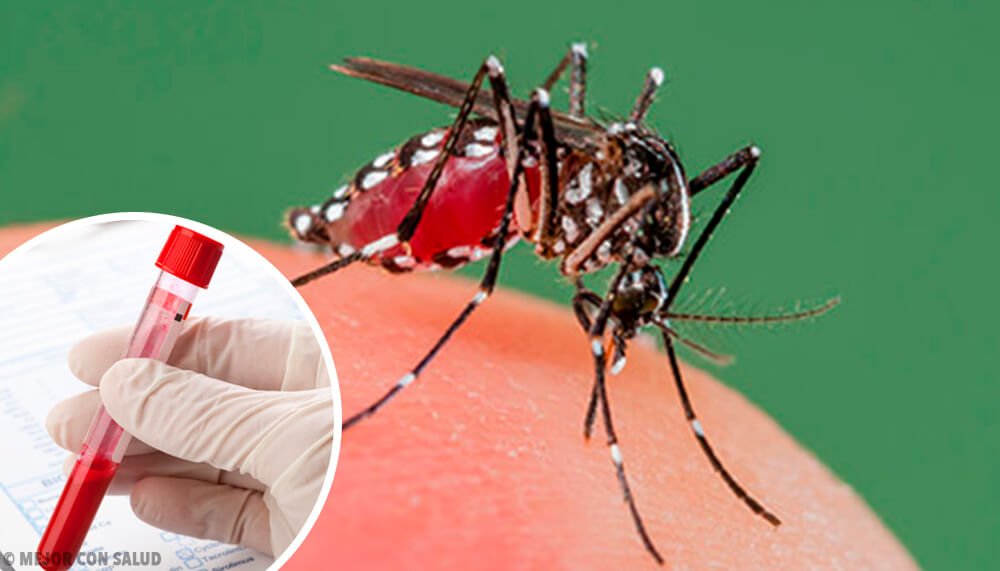 Este 2019 en Santander hay un aumento del 300% del virus del dengue a comparación del año anterior.
