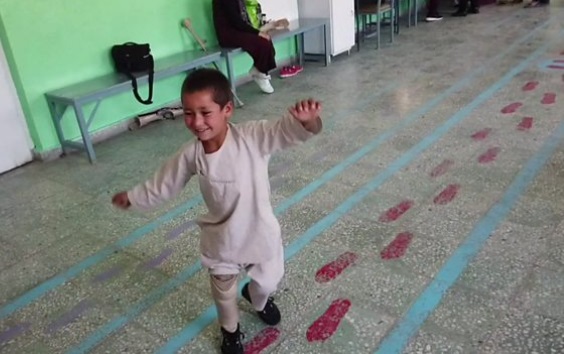 Este es el niño amputado que baila de felicidad al recibir una nueva prótesis