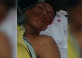 Sujetos hicieron pasar a su víctima como ladrón y la comunidad casi lo lincha por equivocación
