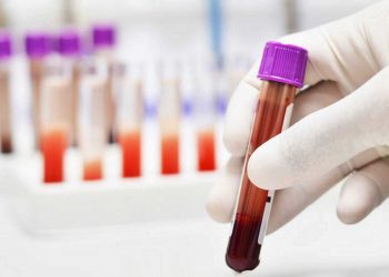 Dieron «negativo» a Coronavirus los resultados de las muestras tomadas a 12 personas en Arauca