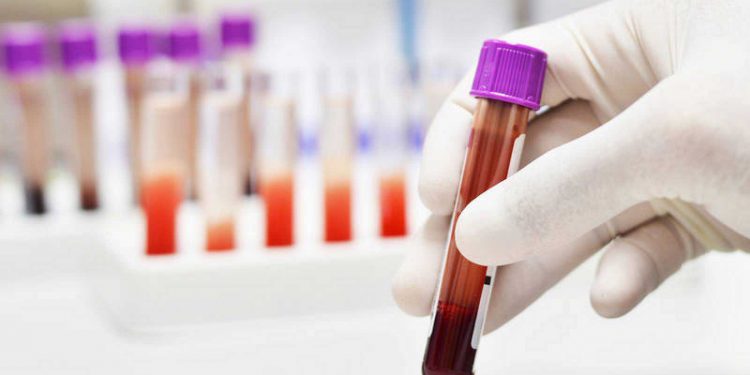 Dieron «negativo» a Coronavirus los resultados de las muestras tomadas a 12 personas en Arauca