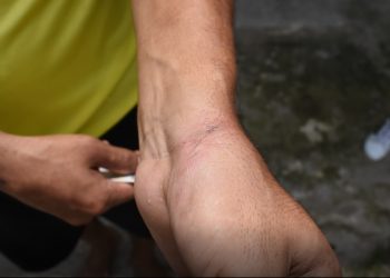 Joven denunció que fue golpeado por patrulleros de la Policía Nacional