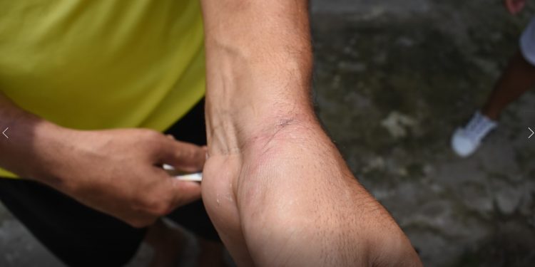 Joven denunció que fue golpeado por patrulleros de la Policía Nacional