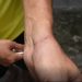 Joven denunció que fue golpeado por patrulleros de la Policía Nacional