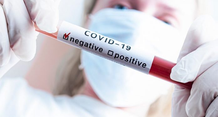Pruebas realizadas a familiares de la paciente con Covid – 19 arrojaron resultado negativo