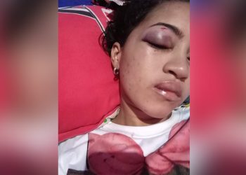 Joven araucana fue brutalmente golpeada por su expareja