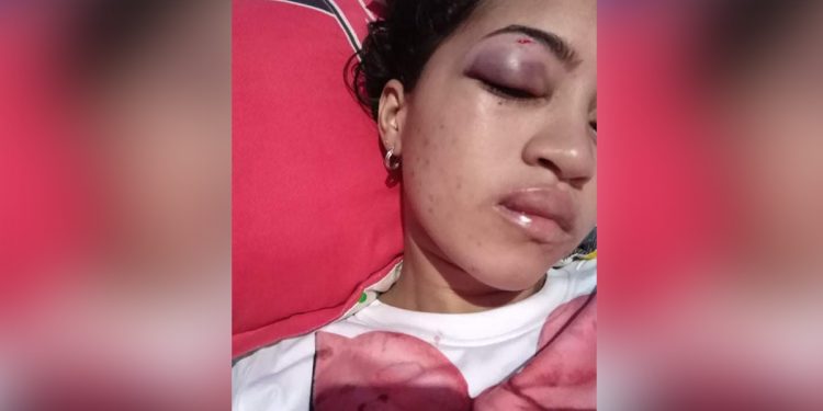 Joven araucana fue brutalmente golpeada por su expareja