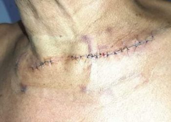 Taxista casi muere degollado  durante un atraco en Arauca