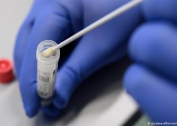 Más de 12.300 pruebas para Covid-19 se han procesado en el Laboratorio de Salud Pública Fronterizo
