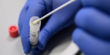 Más de 12.300 pruebas para Covid-19 se han procesado en el Laboratorio de Salud Pública Fronterizo