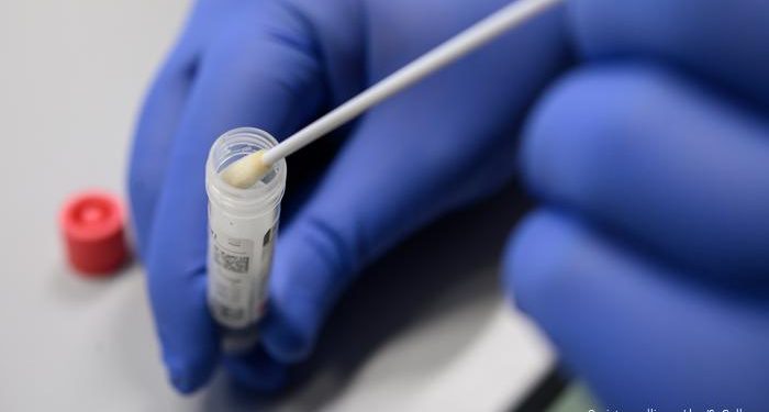 Más de 12.300 pruebas para Covid-19 se han procesado en el Laboratorio de Salud Pública Fronterizo