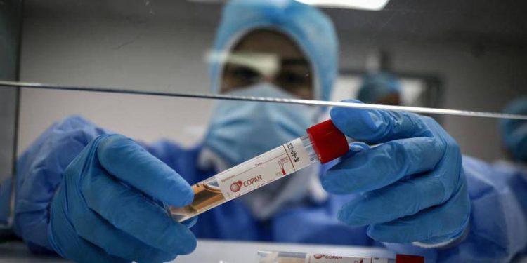 Vacuna contra el covid-19 se aplicará en dos dosis