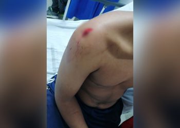 Hombre atacó con machete a un menor de edad en el barrio Fundadores de Arauca