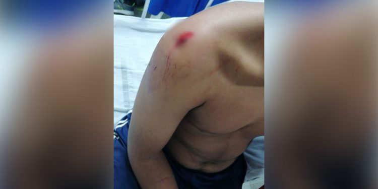 Hombre atacó con machete a un menor de edad en el barrio Fundadores de Arauca