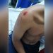 Hombre atacó con machete a un menor de edad en el barrio Fundadores de Arauca