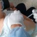 ¿Otro error? Enfermera vacunó dos veces a la misma persona